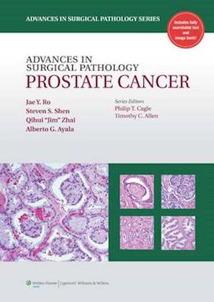 H27Advances in Surgical Pathology: Prostate Cancer