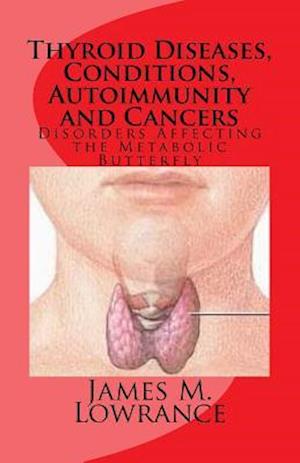 Thyroid Diseases, Conditions, Autoimmunity and Cancers