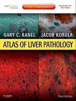 Atlas of Liver Pathology E-Book