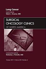 Lung Cancer, An Issue of Surgical Oncology Clinics