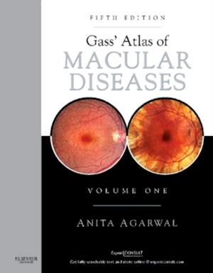 Gass' Atlas of Macular Diseases E-Book