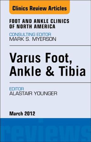 Varus Foot, Ankle, and Tibia, An Issue of Foot and Ankle Clinics