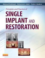 Principles and Practice of Single Implant and Restoration