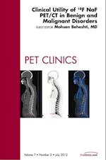 Clinical Utility of 18NaF PET/CT in Benign and Malignant Disorders, An Issue of PET Clinics