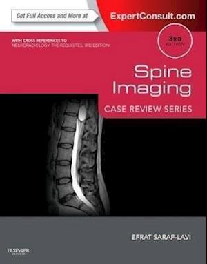 Spine Imaging: Case Review Series