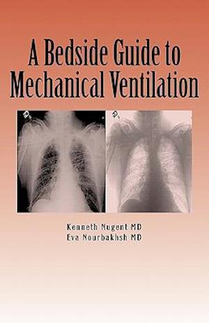 A Bedside Guide to Mechanical Ventilation