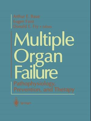 Multiple Organ Failure