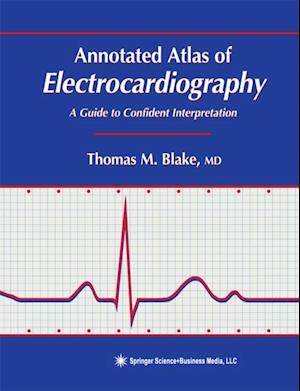 Annotated Atlas of Electrocardiography