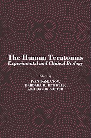 Human Teratomas