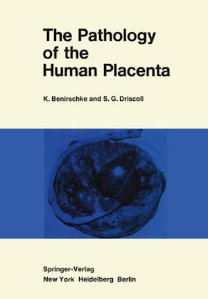 Pathology of the Human Placenta