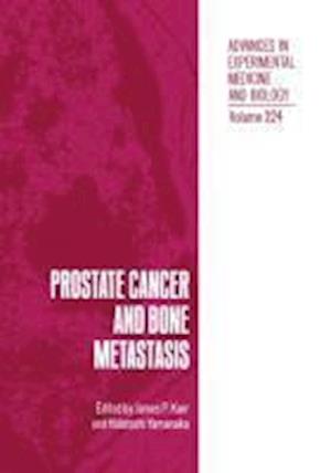 Prostate Cancer and Bone Metastasis