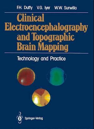 Clinical Electroencephalography and Topographic Brain Mapping