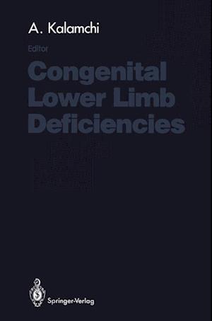 Congenital Lower Limb Deficiencies