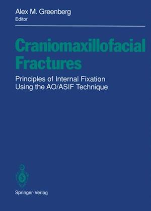 Craniomaxillofacial Fractures