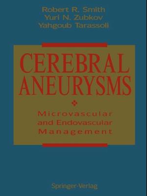 Cerebral Aneurysms