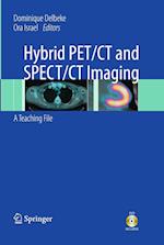Hybrid Pet/CT and Spect/CT Imaging