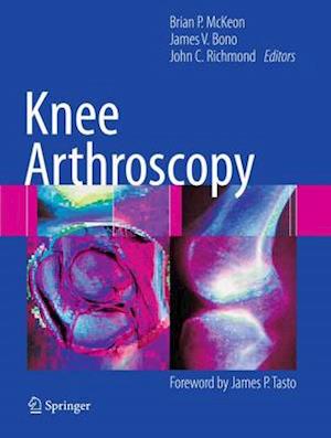 Knee Arthroscopy