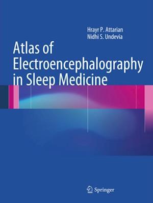 Atlas of Electroencephalography in Sleep Medicine