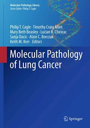 Molecular Pathology of Lung Cancer