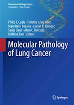 Molecular Pathology of Lung Cancer