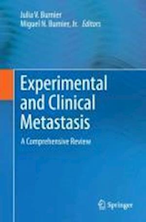 Experimental and Clinical Metastasis