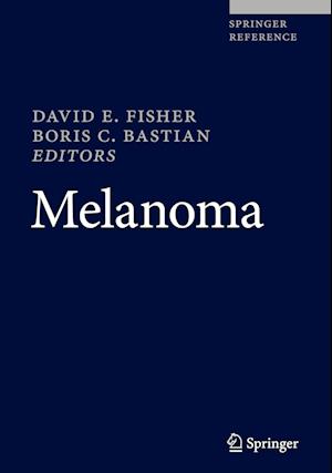 Melanoma