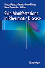 Skin Manifestations in Rheumatic Disease