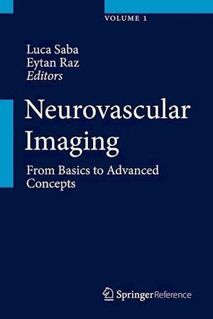 Neurovascular Imaging