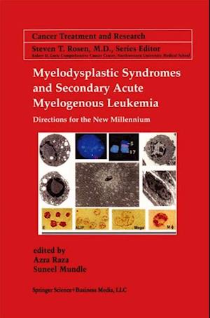 Myelodysplastic Syndromes & Secondary Acute Myelogenous Leukemia