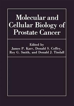 Molecular and Cellular Biology of Prostate Cancer