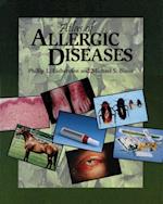 Atlas of Allergic Diseases