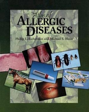 Atlas of Allergic Diseases
