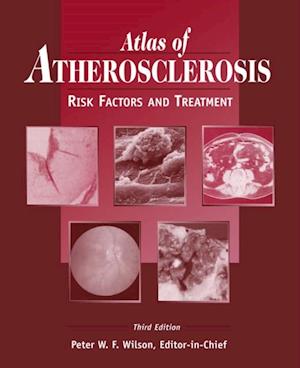 Atlas of Atherosclerosis