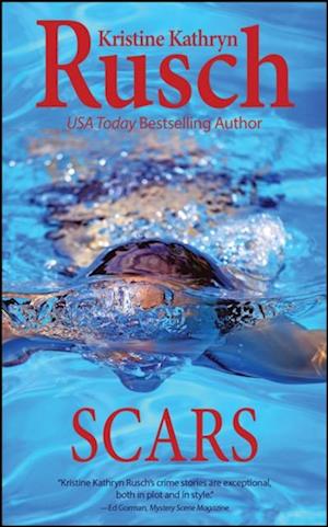 Scars