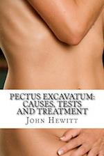 Pectus Excavatum