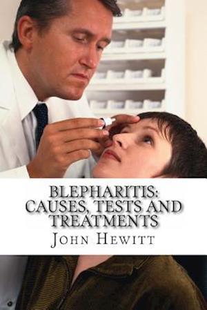 Blepharitis