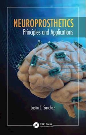 Neuroprosthetics