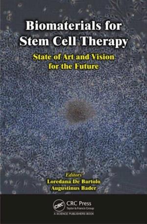 Biomaterials for Stem Cell Therapy