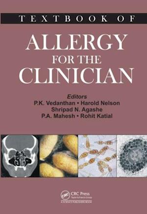 Textbook of Allergy for the Clinician