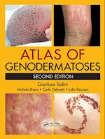 Atlas of Genodermatoses, Second Edition