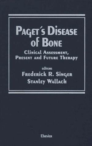 Paget's Disease of Bone