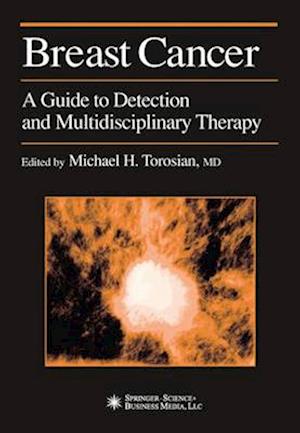 Breast Cancer : A Guide to Detection and Multidisciplinary Therapy