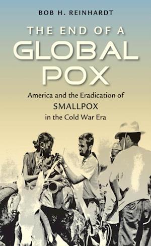 End of a Global Pox