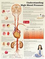 Understanding High Blood Pressure