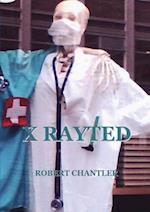 X RAYTED 