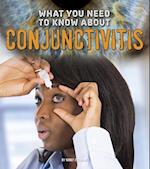 What You Need to Know about Conjunctivitis
