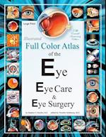 Illustrated Full Color Atlas of the Eye, Eye Care, and Eye Surgery - Large Print Edition