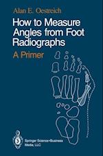 How to Measure Angles from Foot Radiographs