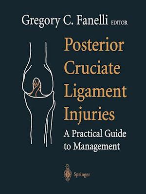 Posterior Cruciate Ligament Injuries