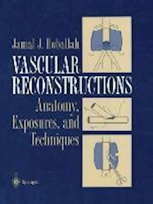 Vascular Reconstructions